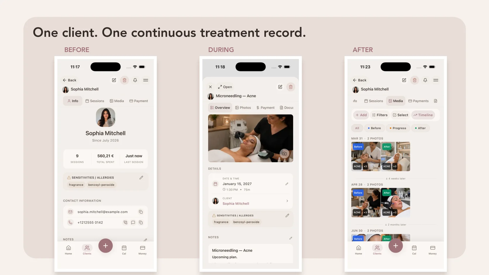 Esthetician Client Records: What to Track Before, During and After Every Treatment