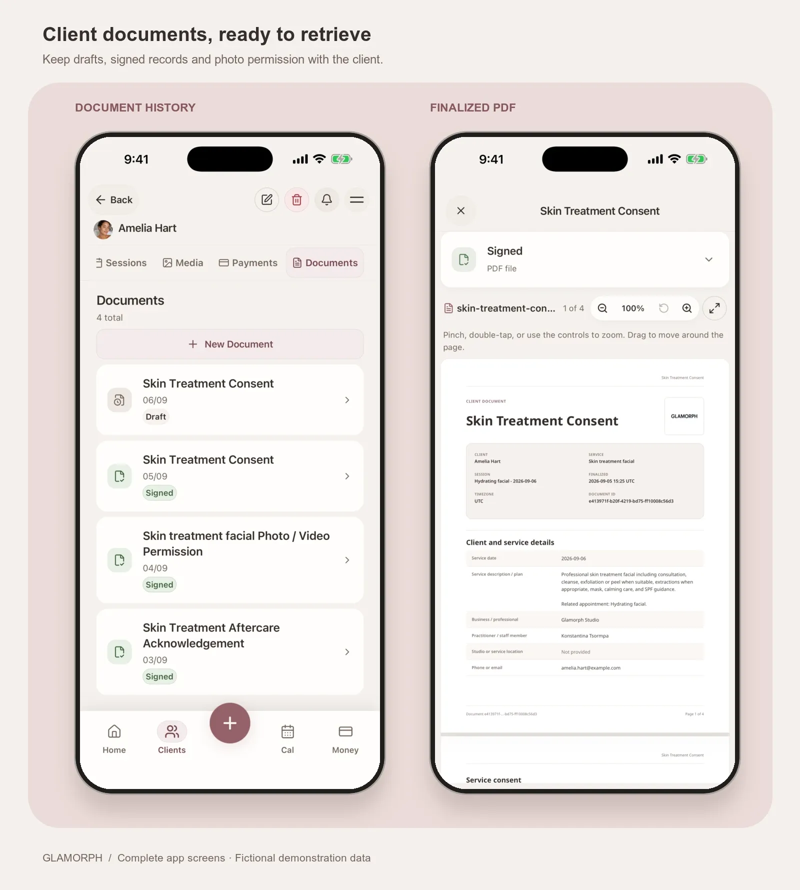 A fictional client's document history and finalized skin-treatment consent in Glamorph.