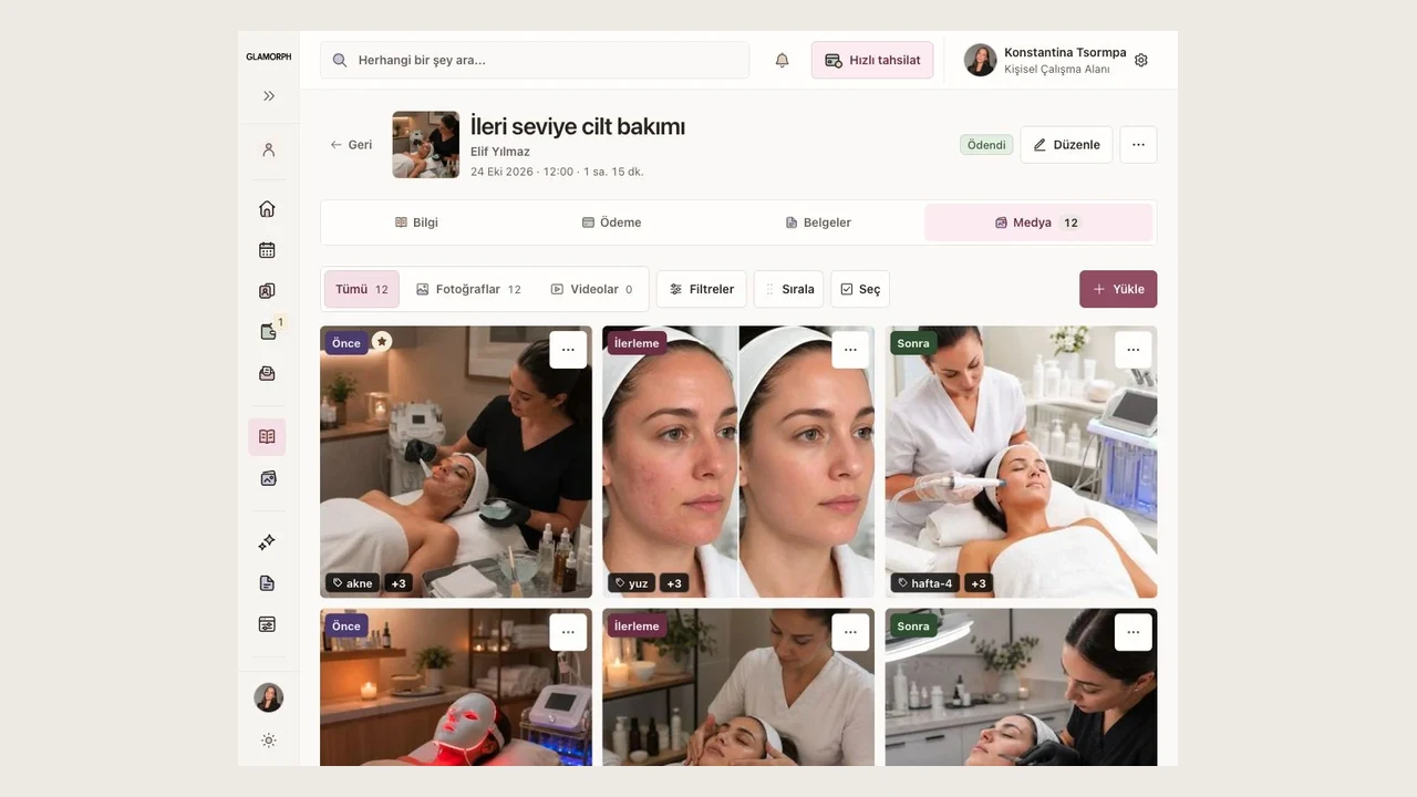Glamorph'ta bir salon işleminin örnek fotoğraf galerisi.
