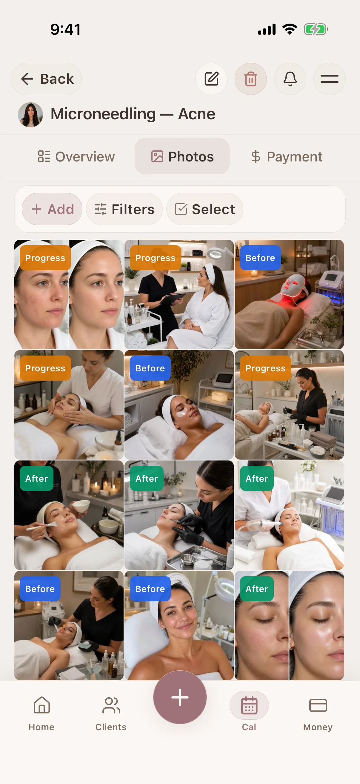 Estheticians Glamorph photo and session history screen
