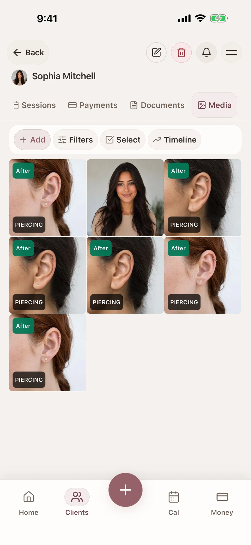 Piercing photos and follow-up records — Glamorph. English interface with example data